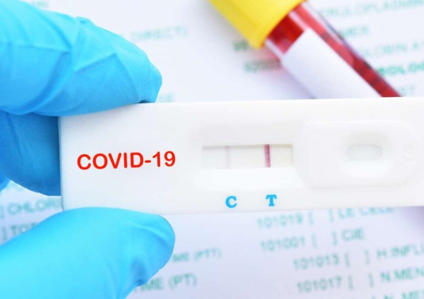 Në SHBA jepet autorizimi për përdorimin e testit të koronavirusit në shtëpi