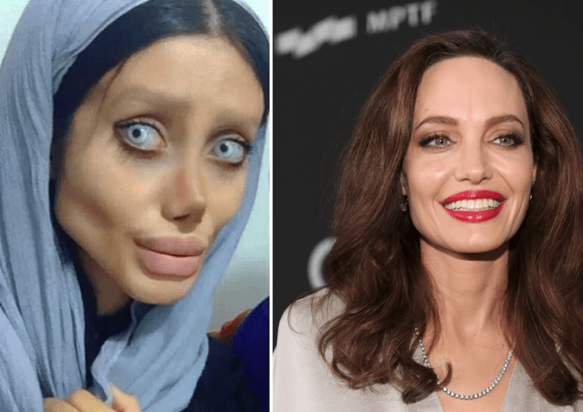 Mbahej nga regjimi i Iranit/ Del nga burgu ‘Angelina Jolie e Iranit’, zbulohet fytyra e saj e vërtetë