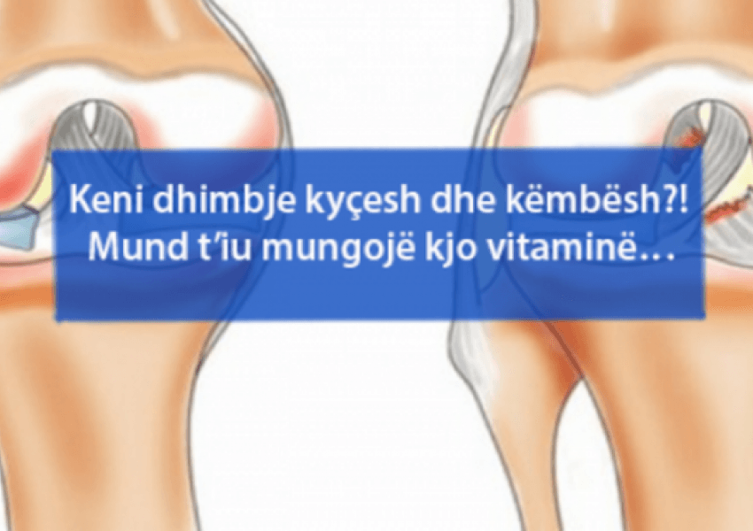 Keni dhimbje kyçesh dhe këmbësh?! Kujdes, mund t’iu mungojë kjo vitaminë