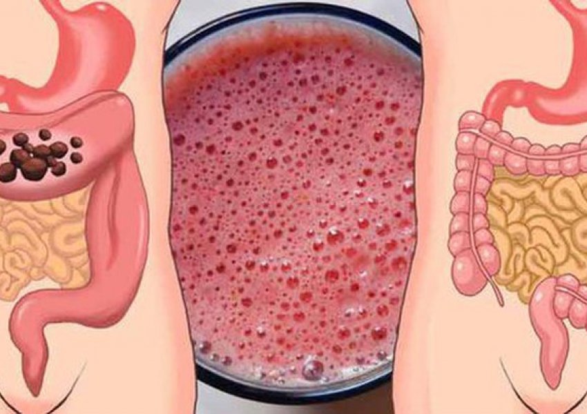 Pija që eliminon 5 kg mbeturina nga trupi juaj për pak ditë