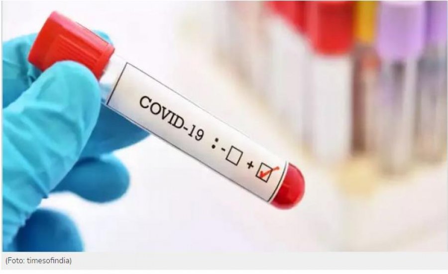 COVID19/ MSH: 6 humbje jete dhe 187 të infektuar në 24 orët e fundit 