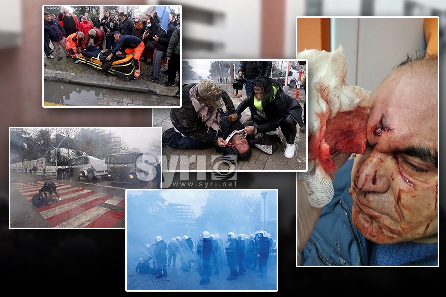 FOTOGALERI/ Rama-Basha dhunë ndaj demokratëve në selinë e PD