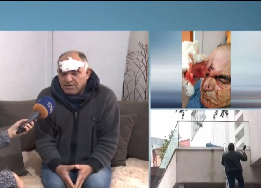 VIDEO-SYRI TV/ U dhunua barbarisht nga mercenarët e Bashës dhe policia, Hoxha: Më qëlluan me predhë në kokë