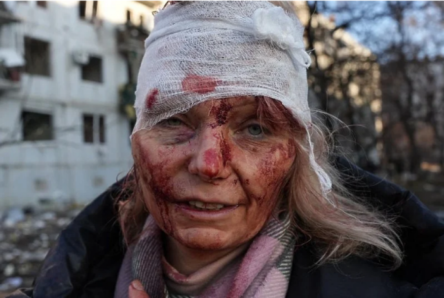 Lufta Rusi-Ukrainë/ Fotoreporteri amerikan: Është e vështirë të shikosh foto si ajo e Olenës, por duhet bërë