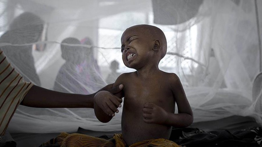 Shpërthen kolera, qindra të vdekur në Afrikë, pezullohet hapja e shkollave