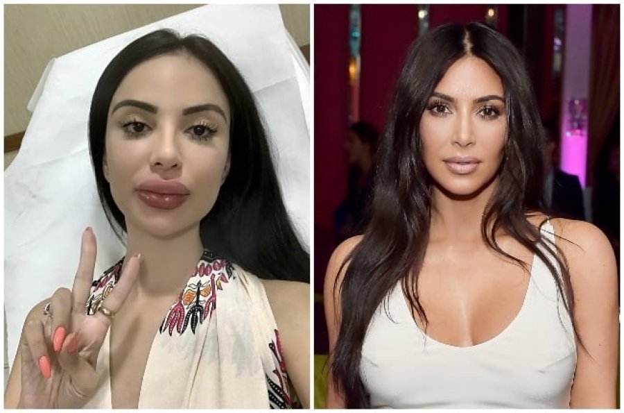 Donte të dukej si Kim Kardashian! E reja merr lajmin rrëqethës