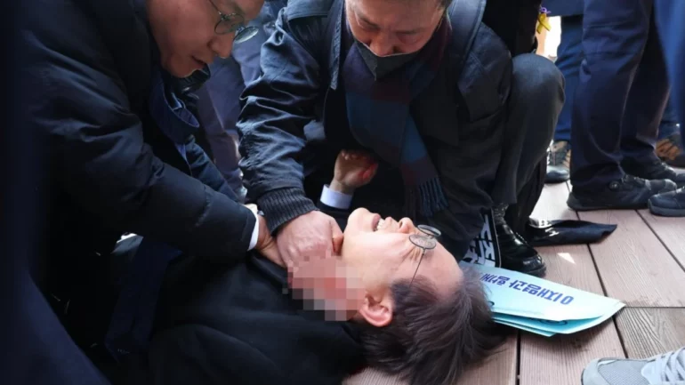 U godit me thikë në qafë, lideri i opozitës së Koresë së Jugut, ja si paraqitet gjendja e tij