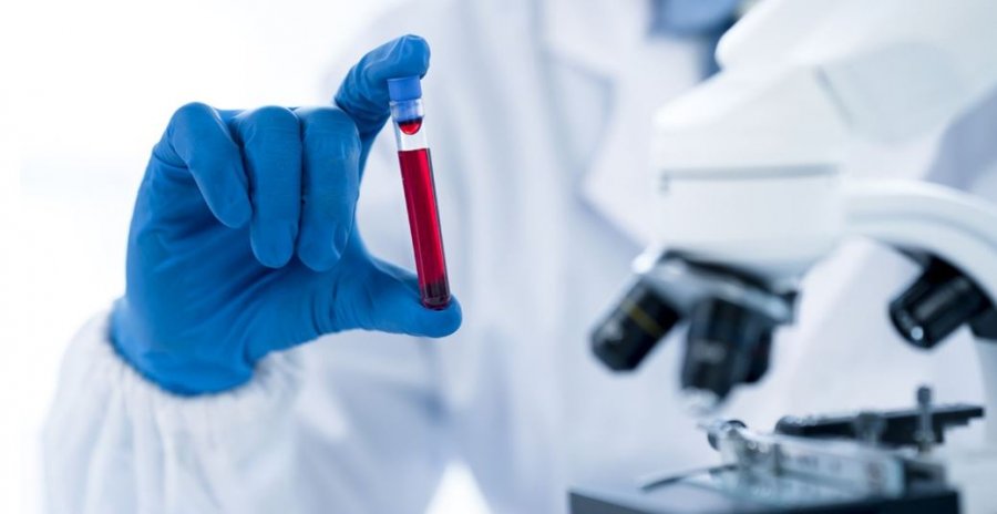 Studimi: Një test i thjeshtë gjaku 'shpëtim' për njerëzit me Alzheimer