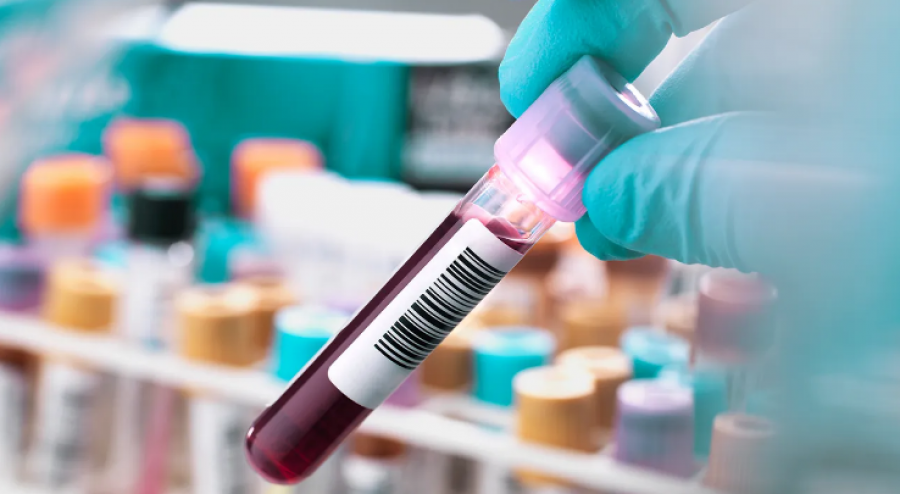 Studimi: Një test i thjeshtë gjaku 'shpëtim' për njerëzit me Alzheimer