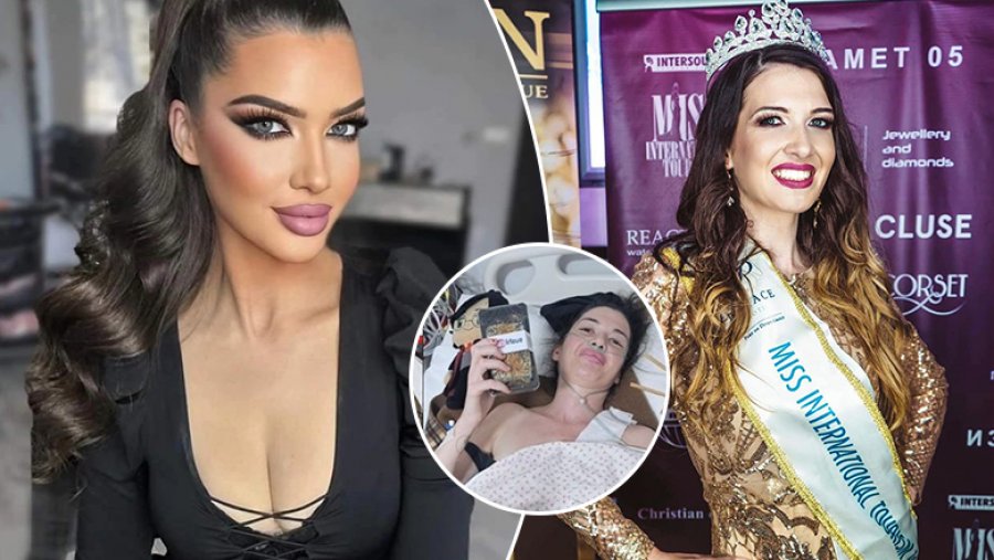 Miss Maqedonia bie nga lartësia duke bërë ‘selfie’, thyen 11 brinjë