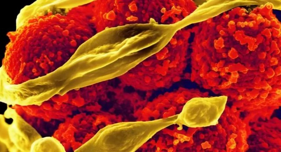 Studimi: Rezistenca e baktereve ndaj antibiotikëve rrit rrezikun për fatalitete